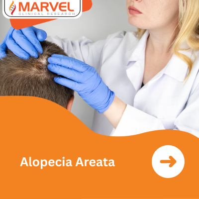 Alopecia areata